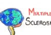 multiple sclerosis (MS)