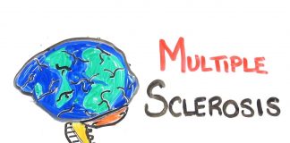 multiple sclerosis (MS)