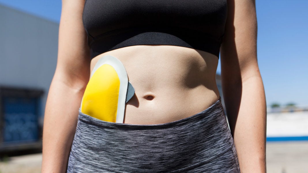 Ostomy