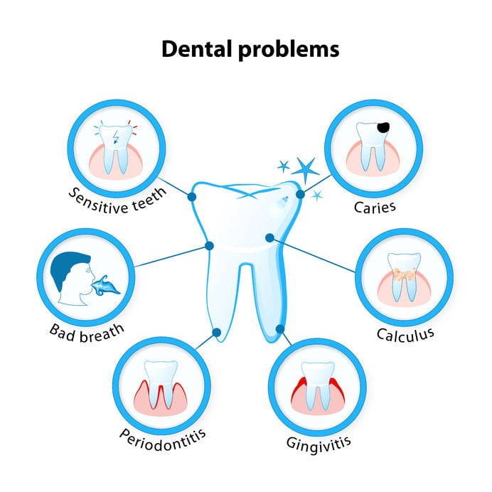 oral health problems